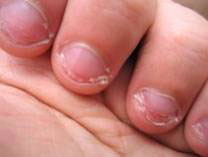 ongles2