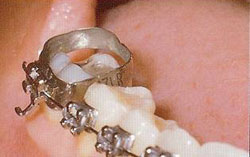 prevenir-problemes-manger7
