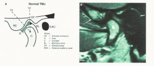 IRMclinique-orthodontie-drelafond