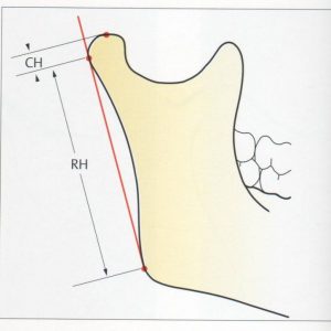 Index Habet- drelafond